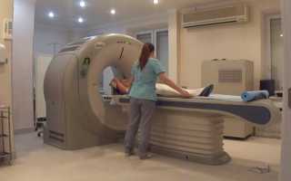Как проходит процедура МРТ позвоночника