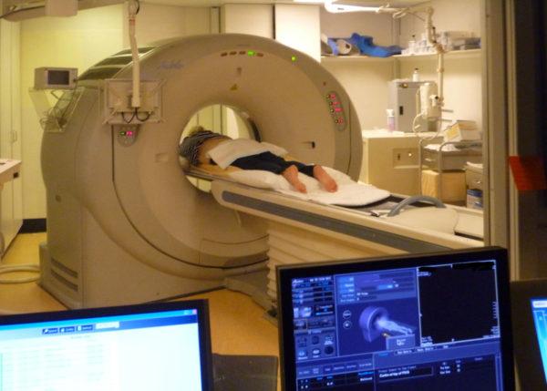 В наше время МРТ сосудов головного мозга – ведущий метод в диагностике практически всех сосудистых заболеваний головного мозга. Этот метод отодвинул на второй план как рентгенографию, так и рентгеновскую компьютерную томографию