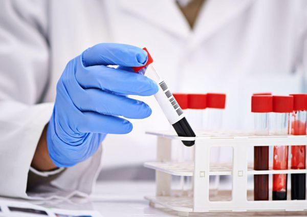 Биохимический анализ крови позволит оценить работу внутренних органов и выявить наличие патогенных микроорганизмов