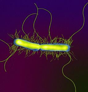 Бакпосев: бактерия протея