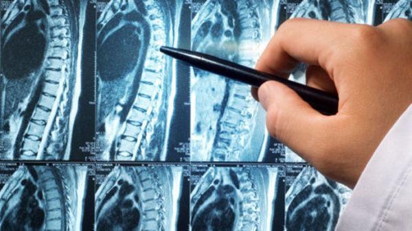 Расшифровку МРТ проводит квалифицированный врач – радиолог