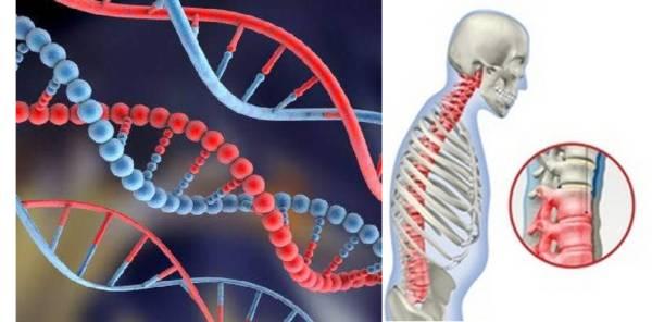 Одним из провоцирующих факторов развития спондилита является генетическая предрасположенность