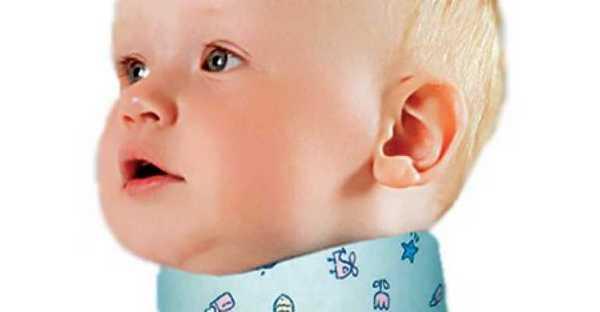 Цель врачей – зафиксировать шею малыша, чтобы она как можно быстрее восстановилась