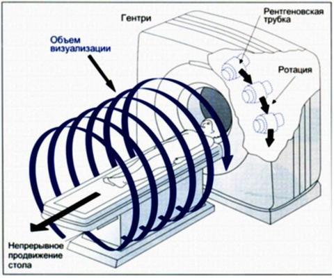 Принцип работы спиральной компьютерной томографии